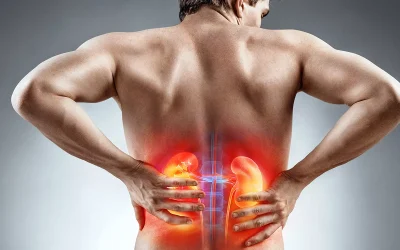 Symptoms of Kidney Stones