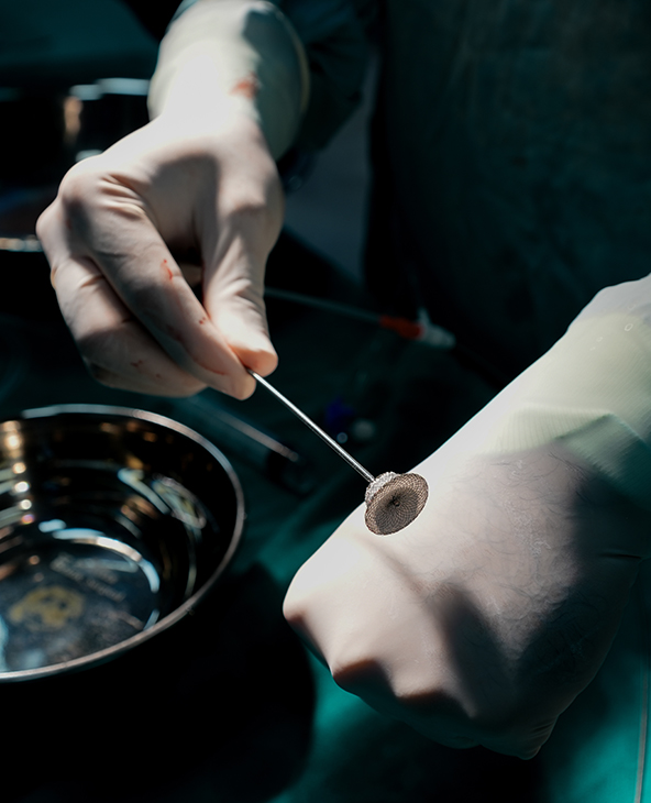 Cardiothoracic and Vascular Surgery (CTVS)