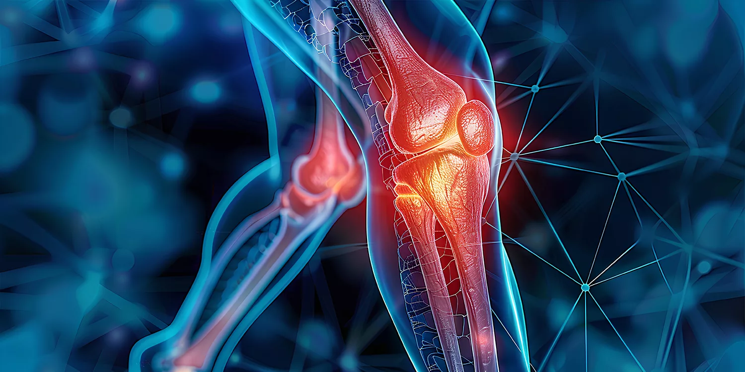 Everything You Should Know About Septic Arthritis