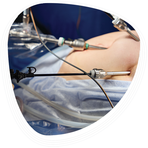 Graphic Era Hospital for Bariatric Surgery