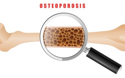 What is Osteoporosis