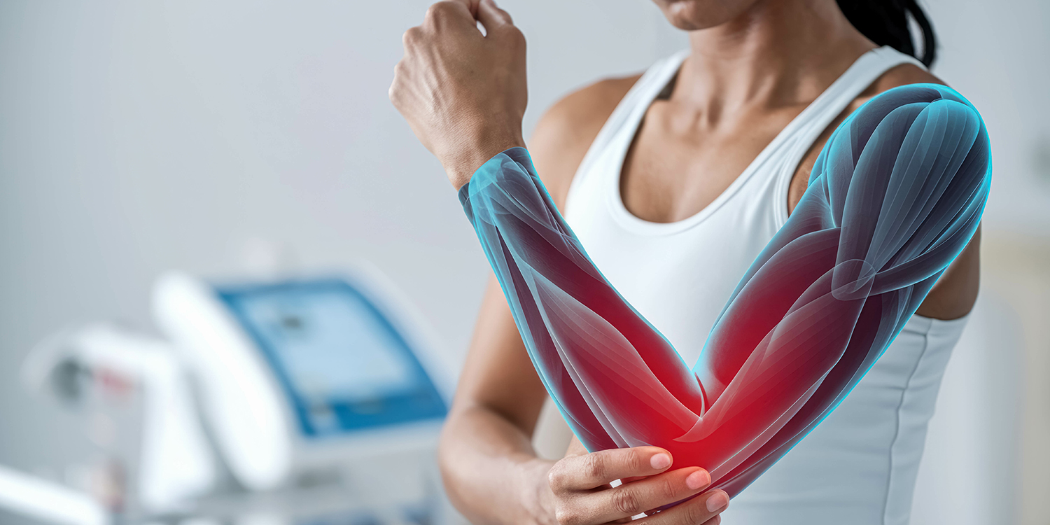 What is a Tennis Elbow? Understanding Causes, Symptoms, Treatments, and Prevention